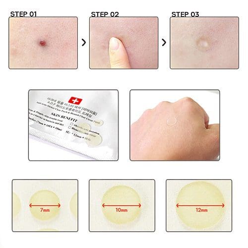Dolly Skin Cosrx Acne Pimple Master Patch